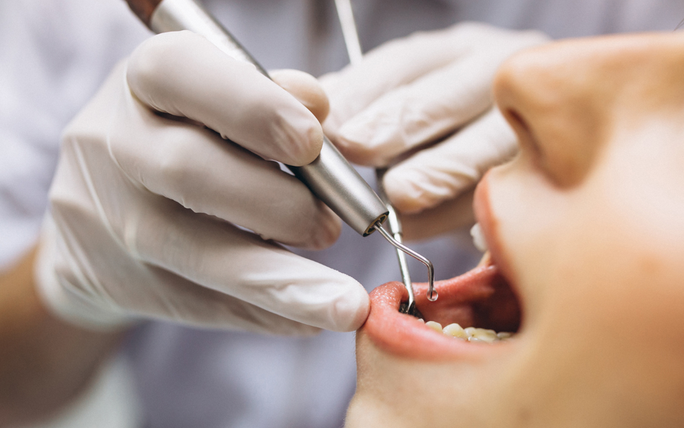 DENTPLANT: Entenda porque é importante visitar o dentista regularmente